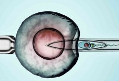 俄罗斯做试管的流程和费用，需要注意这些问题