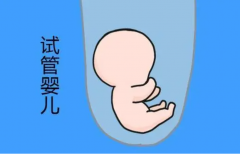 试管利弊谈：科学决策，幸福启航