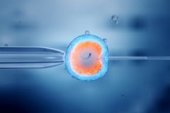 宫腔粘连是怎么引起的?一文了解宫腔粘连的原因!