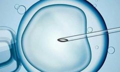 格鲁吉亚的试管市场容易出现乱象的原因