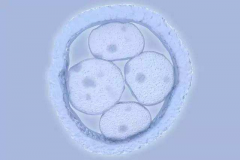 为何选择俄罗斯做试管？高成功率成最大吸引力！