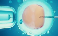 自己去俄罗斯做试管各个阶段的详细步骤介绍