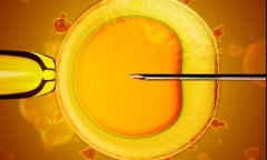 南昌三代试管想生一个男孩子的流程解析