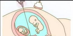 广西哪些公立医院可以为未婚夫妇提供试管？
