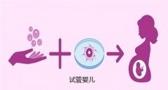 揭秘！做试管适用条件与标准一览