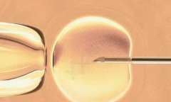 2024年临沂三代试管生'男'孩费用价格表！