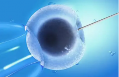 马来西亚试管费用全解析：明细与质量保证深度剖析！