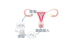 试管移植后上厕所，宝宝会掉出来吗？