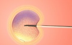 不孕夫妻实现生育梦想，拉拉试管原理和流程介绍