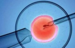 了解女性生殖系统状况,试管移植前女性在月经期间要做什么检查？