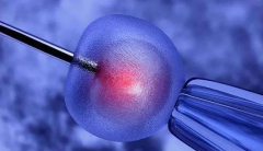 黄体期方案成试管新宠？看看你是否适合这四大人群！