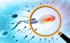 精子DFI高达标，试管之路并非绝境