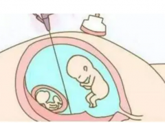 揭秘降调周期移植全步骤：从启动到完成，天数详尽解析！