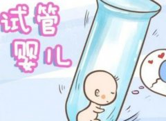 胖多囊患者在试管过程中需要注意的问题