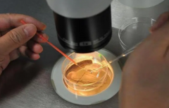 试管自然周期移植：回归自然，三大优势与潜在挑战