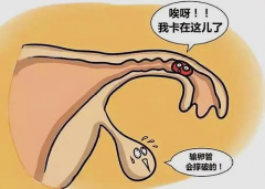 输卵管堵塞后，生二胎用试管难不难？优势与必知事项！