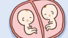 马来西亚试管的费用预算及费用明细，马来西亚试管的建议