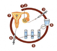 梅毒抗体阴性，做试管会有影响吗？专家全面解析来解惑！