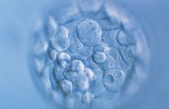 试管不成功的其他解决方案，根据自己的情况选择治疗方法