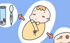 江苏试管操作流程是怎么样的？遵循医生的建议进行治疗