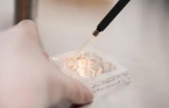 长方案OR短方案？试管前的关键抉择，一文读懂