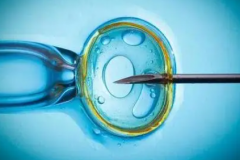 赴俄做试管攻略：详细流程大揭秘