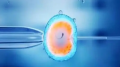 试管自然周期：方案揭秘，移植前工作与步骤详解