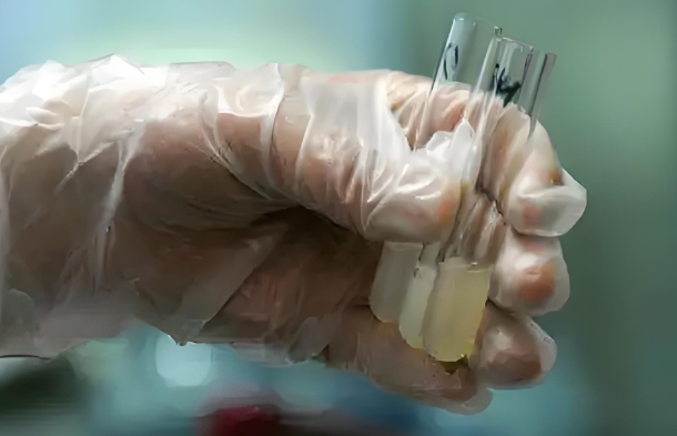 男性精子异常可以做试管吗?需要满足哪些条件?