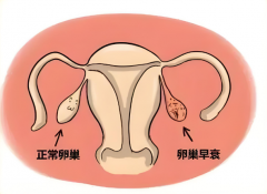 37岁卵巢早衰试管成功率有多少？一文了解试管成功率的提高措施！