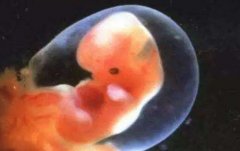 发烧对试管移植的影响，应该如何处理发烧情况？