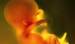 试管技术的发展和改进，试管与自然产生宝宝的缺陷风险比较