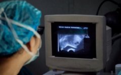 注意！试管手术前，这两项检查的有效期不可忽视