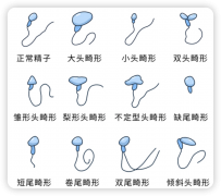 精子畸形率70%?!成都这些医院能做第三代试管，别再绝望!