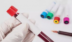 试管移植前必看：空腹or非空腹？一秒决策，助你顺利过关！