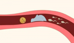 输卵管堵塞不再愁！备孕攻略：疏通手术VS试管，如何选择更高效？