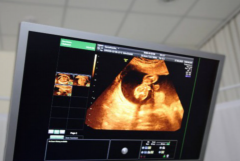 同房时间有讲究：试管取卵后多久合适？过早过晚的影响解析