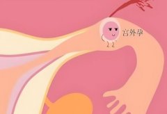 宫外孕试管成功率高吗,试管如何防止宫外孕