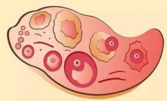 揭秘！取卵数量少，试管妊娠率竟能高？专家详解身体评估关键