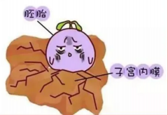 ‌41岁挑战试管？揭秘高龄夫妇提升成功率的关键策略！