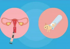 泰国三代试管费用大公开！真实收费明细全分享，一次搞懂不花冤枉钱