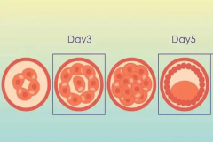囊胚培养的五大好处，试管夫妇建议看看！