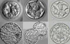 3CB囊胚质量如何，直接关系试管移植成功率！