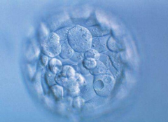 想提高试管成功率，这四点一定要做好才行！