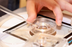 试管卵子和精子为什么要提前冷冻？有三大好处！