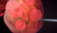 试管取卵不是越多越好，贪多危害大！