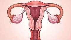 巧克力囊肿遇上试管婴儿：成功率如何？一探究竟！‌