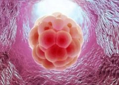 试管取卵：疼痛只是传说？听听过来人的真相！