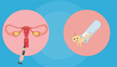 罗氏易位做试管，胚胎挑选需谨慎！快来学学怎么筛选更好吧！