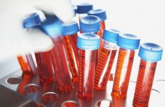 试管移植后雌二醇低？别忽视，医生指导调整是关键！