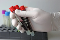 移植囊胚前，检查发现抽血数值太低有影响吗？